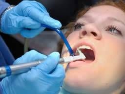 Cracked tooth: Symptoms, diagnosis, and treatment